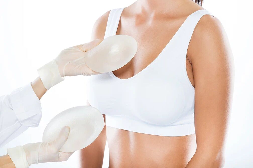 Sélection d'implants avant une chirurgie d'augmentation mammaire. 