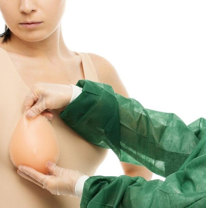 implants d'augmentation mammaire